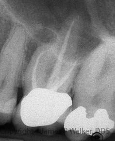 Molar